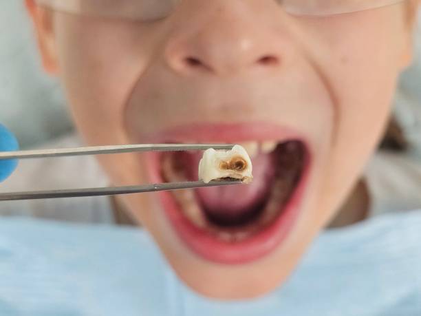Best Emergency Pediatric Dentist  in Parkersburg, WV